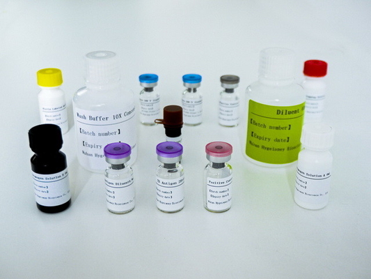 टीबी के लिए आसान-IGRA ELISA टेस्ट किट लंबे शेल्फ जीवन और 2C-8C संरक्षण विधि के साथ