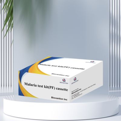 मलेरिया एंटीजन रैपिड डायग्नोस्टिक टेस्ट आरडीटी डिटेक्शन रीडिंग टाइम रैपिड टेस्ट रिएजेंट