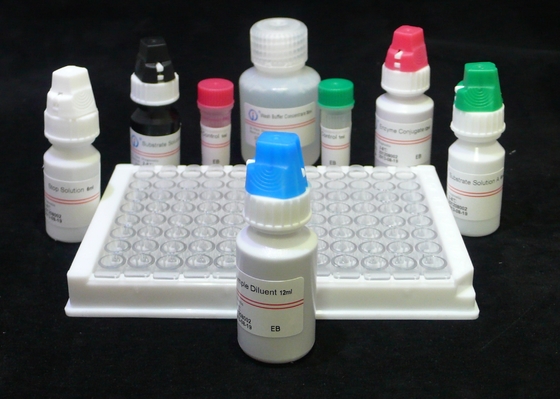 ISO13485 एचआईवी एबी एजी टेस्ट एचआईवी चौथी पीढ़ी परख एलिसा किट 60 मिनट