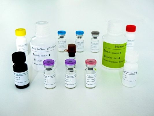 सीरम प्लाज्मा टीबी-आईजीआरए