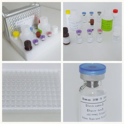 सीरम प्लाज्मा टीबी-आईजीआरए