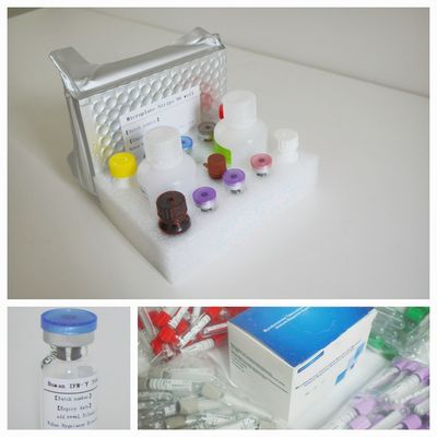 सीरम प्लाज्मा टीबी-आईजीआरए