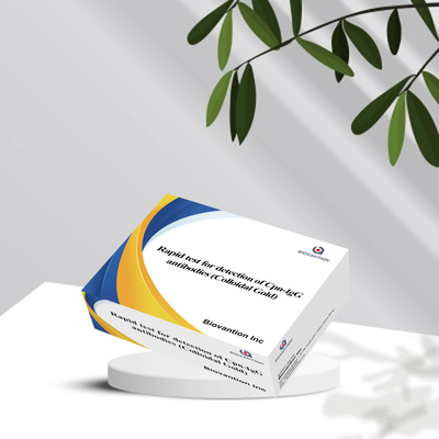 Chlamydiapneumoniae ((Cpn) -IgM एंटीबॉडी कैसेट कोलोइडल गोल्ड रैपिड टेस्ट रिएजेंट
