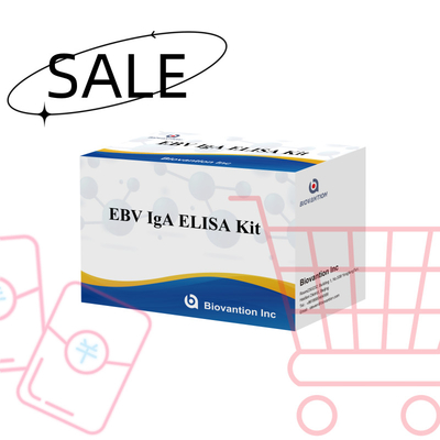 EBV-Zta के प्रति IgA एंटीबॉडी के लिए डायग्नोस्टिक किट के लिए प्रोफेशनल एलिसा टेस्ट किट