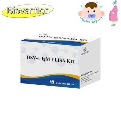 टॉर्च ELISA टेस्ट किट HSV 1 IgM उच्च गर्म बिक्री नैदानिक अभिकर्मक IVD
