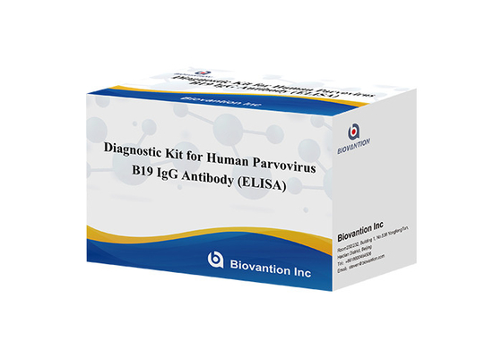 मानव पार्वोवायरस B19 IgM ELISA टेस्ट किट डायग्नोस्टिक किट