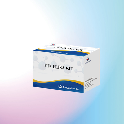 TOXO IgM IgG igg igm elisa kit for human use डायग्नोस्टिक रिएजेंट टेस्ट किट 96 किट के साथ