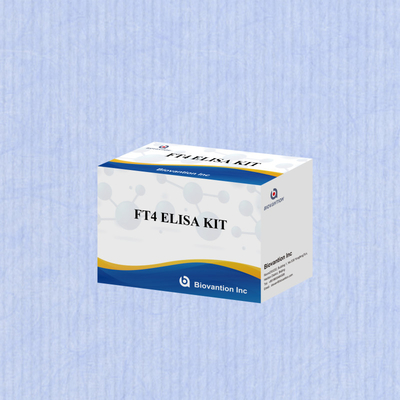 TOXO IgM IgG igg igm elisa kit for human use डायग्नोस्टिक रिएजेंट टेस्ट किट 96 किट के साथ