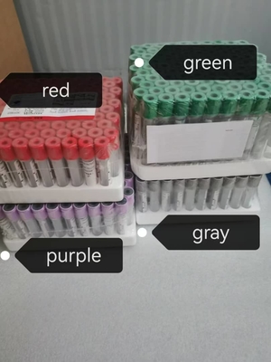 टीबी के लिए आसान-IGRA ELISA टेस्ट किट लंबे शेल्फ जीवन और 2C-8C संरक्षण विधि के साथ