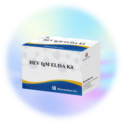 निदान और विश्लेषण के लिए सटीक और संवेदनशील एलिसा टेस्ट किट HEV-IgM