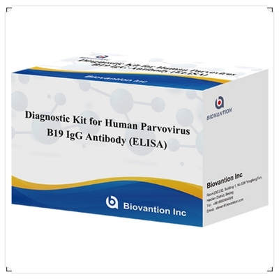 फैक्टरी प्रत्यक्ष बिक्री B19 ELISA Kit For Human Parvovirus B19 IgM एंटीबॉडी एलिसा टेस्ट किट 96T के साथ