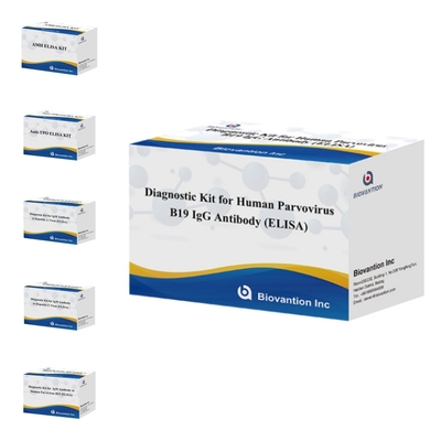 फैक्टरी प्रत्यक्ष बिक्री B19 ELISA Kit For Human Parvovirus B19 IgM एंटीबॉडी एलिसा टेस्ट किट 96T के साथ