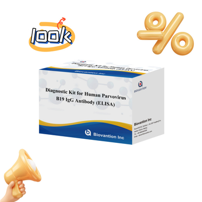 फैक्टरी प्रत्यक्ष बिक्री B19 ELISA Kit For Human Parvovirus B19 IgM एंटीबॉडी एलिसा टेस्ट किट 96T के साथ