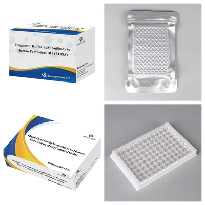 मानव पार्वोवायरस B19 IgM एंटीबॉडी ELISA के लिए डायग्नोस्टिक किट एरिथेमा इंफेक्टिओसम और गर्भावस्था में जटिलताओं के लिए आदर्श